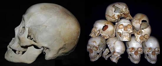 human skulls