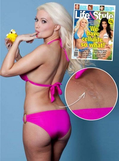 Holly Madison after the tattoo removal