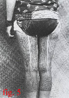 fig.5 Click for a closer look at these Dayak woman's thigh tattoos