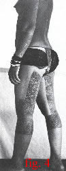 fig.4 Click for a larger picture of thigh and calf tattoos of a Dayak woman.