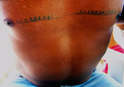 Matsés chest tattoos.